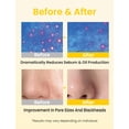 thumbnail image 2 of Aceite Limpiador Elvira Pore Control Makeup Remover Sensitive, 2 of 7