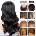 thumbnail image 4 of Fiudx Acete Capilar, Elixir En Menta y Biotina, Sérum Reparador En Puntas Abiertas, Gotas Nutritivas En Cuero Cráneo, Rutina Diaria En Cuidado Capilar, Todo Tipo En Cabello, Fórmula Ligera En 50 Ml, 4 of 7
