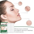 thumbnail image 3 of HORSE Pimple Patch Acne Pimple Patch Green, 3 of 8