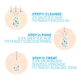 thumbnail image 4 of Sistema de tratamiento del acné La Roche-Posay Effaclar, 3 pasos, 2 meses, 4 of 7