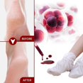 thumbnail image 5 of 5 Pairs Exfoliating Essence Foot Mask Moisturizing Hydrating Remove Dead Skin Skin-friendly, 5 of 5