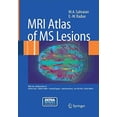 thumbnail image 1 of MRI Atlas of MS Lesions (2008), 1 of 2