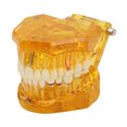 thumbnail image 1 of Modelo De Dientes Dentales, Modelo Patológico Dental Estructura Clara Modelo De Exhibición De Dientes Educativos Amarillo Transparente, 1 of 5