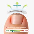 thumbnail image 4 of Corrector de uñas encarnadas Maxship Kids, suave y seguro, 4 of 7