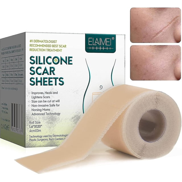 Yesos de silicona para cicatrices, películas de silicona para cicatrices para cirugías, cesárea, queloides, quemaduras, cinta de silicona para cicatrices-4cm*3m