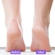 thumbnail image 5 of Foot Pumice Stone 2-Pack | Double Sided Exfoliating Scrubber - Callus Remover for Feet & Heels | Cracked Heel Repair | Dead Skin Cleaner | Premium Material | 5x2x1 inch, 5 of 9