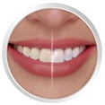 thumbnail image 4 of Crest 3D White Whitestrips, 4 of 4