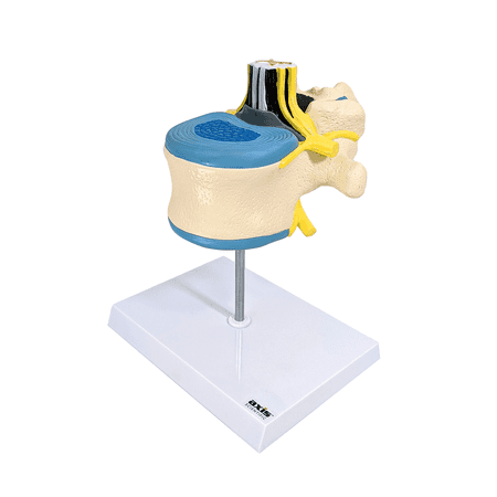 Axis Scientific Enlarged Lumbar Vertebrae with Spinal Cord and Nerves - Perfect for Students, Teachers, Chiropractors, Physical Therapists, Patient Consultation - Includes Full Color Study Guide