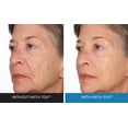 thumbnail image 3 of INSTA-TOX Sérum Raffermissant pour le Visage, Lissant les Rides et Crème Raffermissante Reverse Lift - Raffermisseur pour les Ridules, les Rides Profondes et les Pores - Lift Temporaire pour le Visage et les Yeux - Serious Skinca, 3 of 9