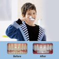 thumbnail image 3 of Kids U Shaped Toothbrush W/ Case, Kids Baby Toddlerinfantu Toothbrush For 360 Oral Cleaning Teeth Whitening Gums Massage, Replable U Shaped Toothbr, 3 of 3