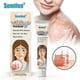 thumbnail image 1 of Extract Vitiligo Ointment Remove Ringworm White Spot Removal Skin Vitiligo Eliminate Vitiligo Treatment Cream_c*, 1 of 5