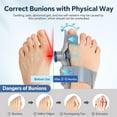 thumbnail image 3 of Bunion Corrector, Adjustable Knob Bunion Splint for Bunion Relief, Women & Men Big Toe Separator Pain Relief, Day Night Support, Suitable for Left and Right Feet, 3 of 9