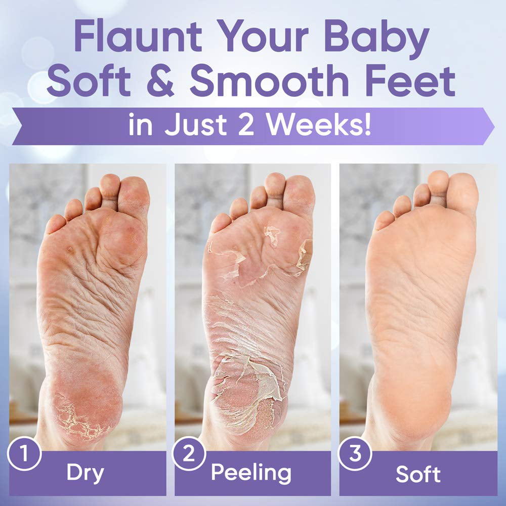 Foot Peel Mask Treatment (2 Pack) Dead Skin Remover For Feet, Dry Cracked Feet, Exfoliator Gel Fixes Cracked Heels, Peeling Baby Soft Smooth Skin, Lavender - Birthday Gifts for Women - Walmart.com