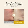 thumbnail image 4 of Suero Mist de Gel Medicube Turmeric Vitamin Gold con Vitamina C, 4 of 9