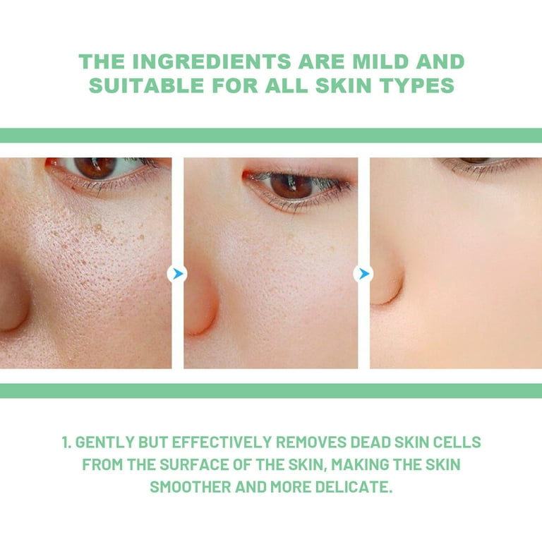 JIASONJY Herbal Exfoliating Gel Mildly Cleans Closed Mouth JIASONJY Herbal Exfoliating Gel Mildly Cleans Closed Mouth