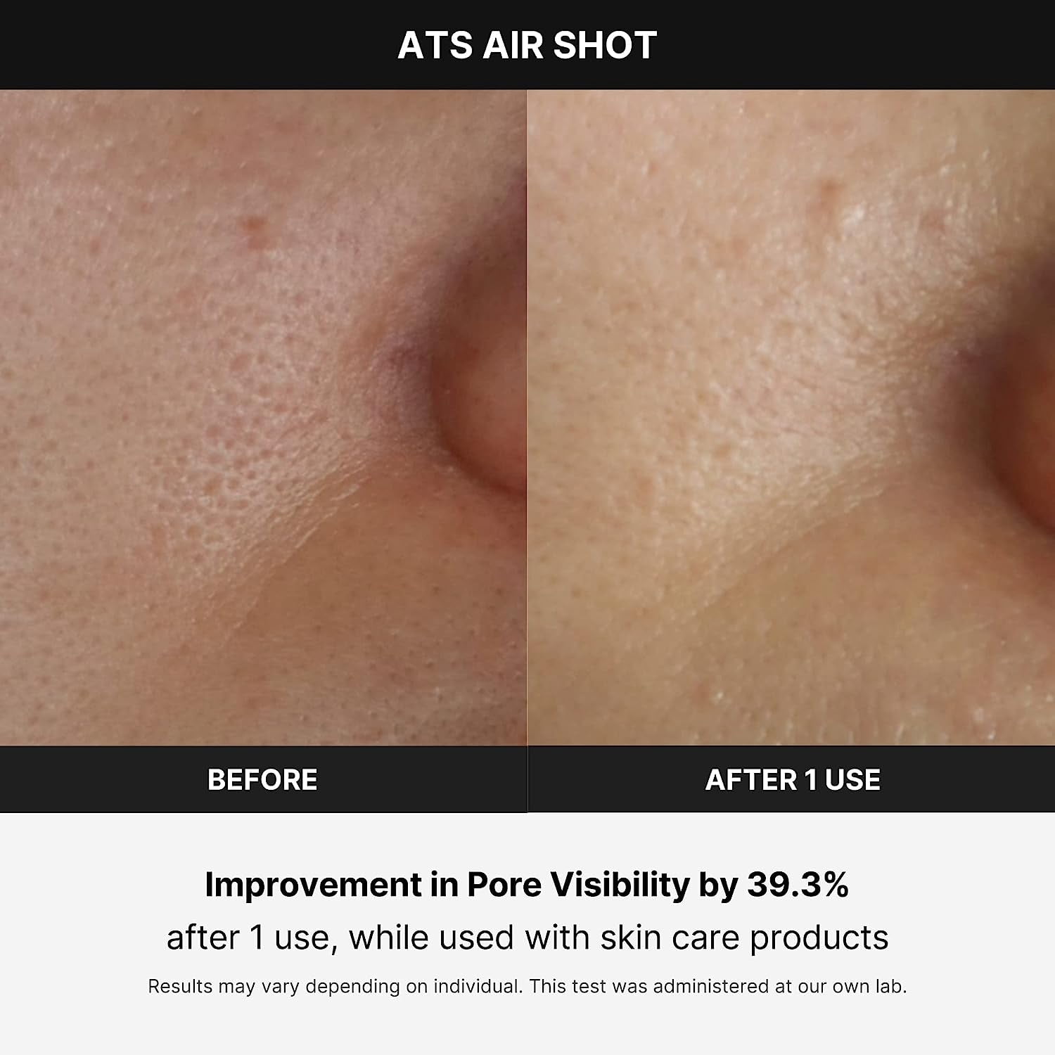 AGE-R BOOSTER & ATS AIR SHOT セット Medicube Age-R ATS Air Shot, Microneedling Pore Tightening