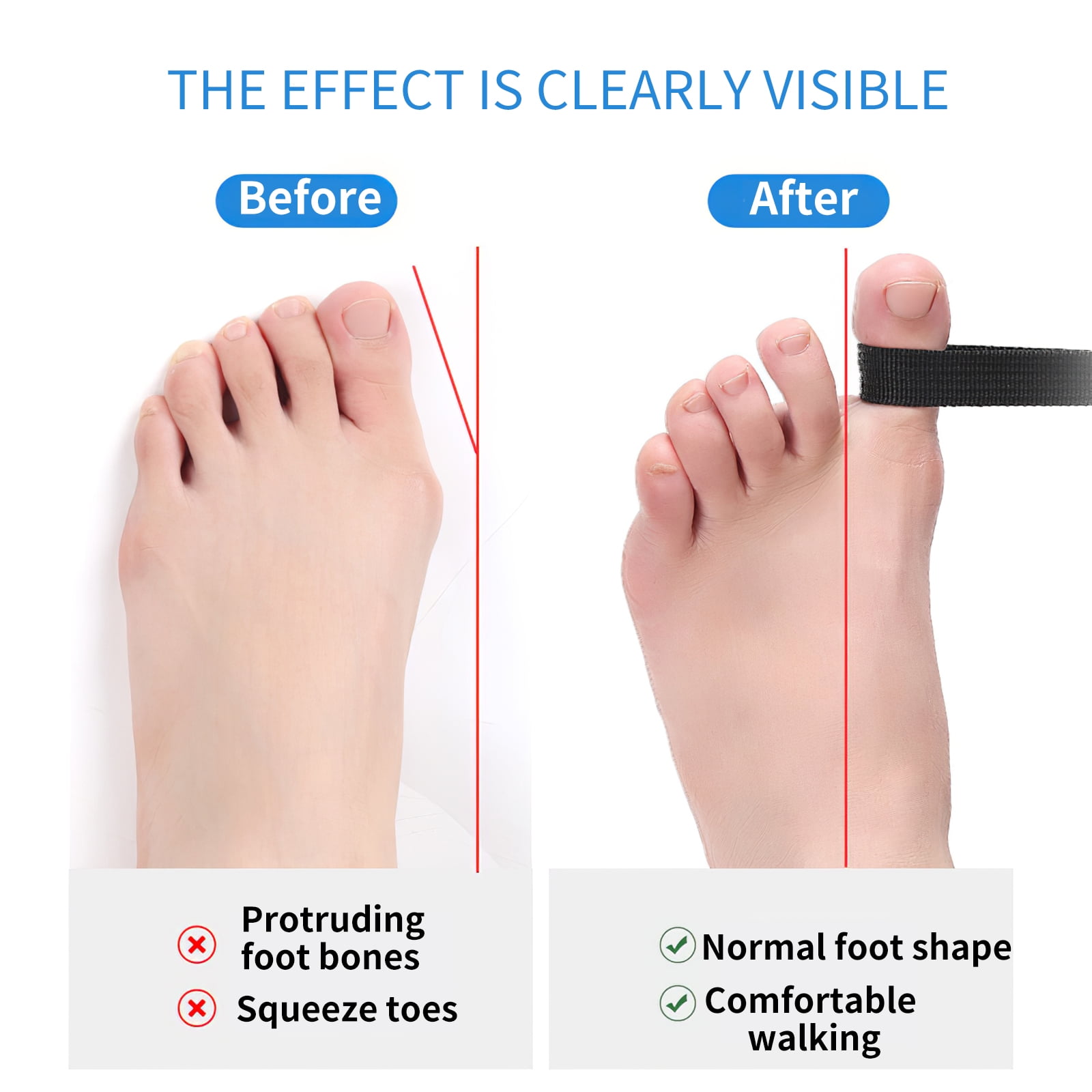 Do Bunion Correctors and Protectors Really Work?and How