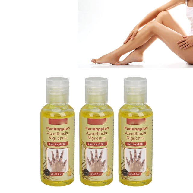 Aceite de Quiebra de Acantosis nigricans, no Grasiento Iluminan El Tono de la Piel Acantasis Nigricans Aceite 3 piezas de 50 ml para tobillos