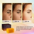 thumbnail image 2 of VALITIC Kojic Acid Vitamin C and Retinol Soap Bars with Turmeric for Dark Spot - Original Japanese Complex Infused with Collagen, Hyaluronic Acid, and Vitamin E (2 Pack), 2 of 3