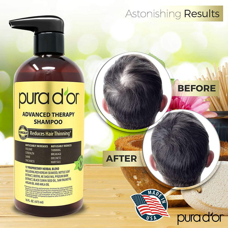  PURA D'OR Advanced Therapy Shampoo (16oz) Reduces Hair Thinning  & Increases Volume, No Sulfate, Biotin Shampoo Infused with Argan Oil, Aloe  Vera for All Hair Types, Men & Women (Packaging May