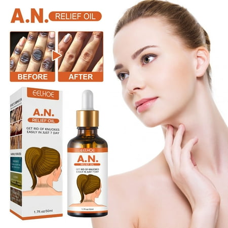 

amousa 50mlRemoving Black And Brightening White Hypostat Oil Remove Keratin And Promote Cell Resume To Reduce The Thickness And Blackness Of Affected Skin