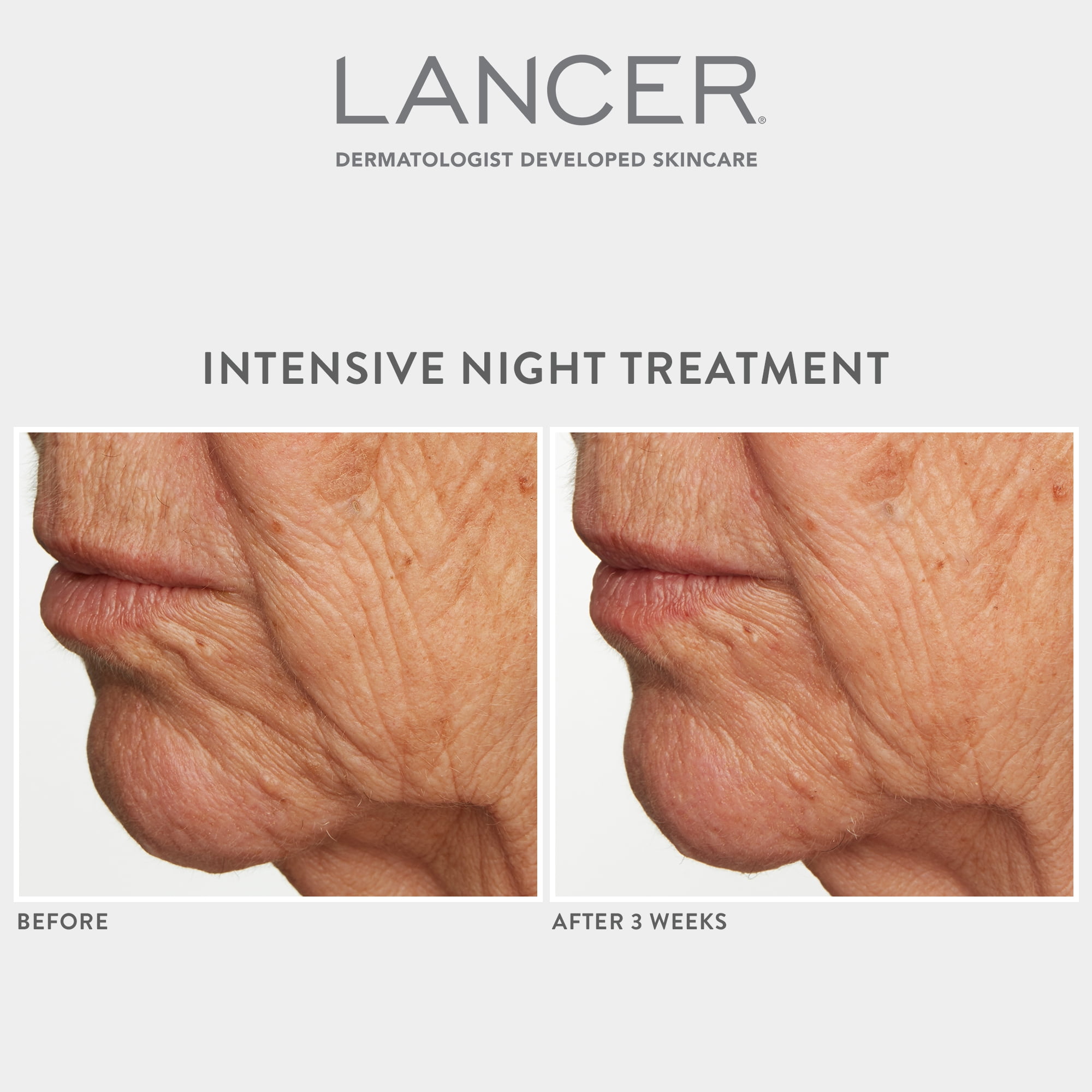 Lancer Intensive Night Treatment