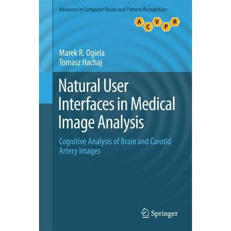 Natural User Interfaces in Medical Image Analysis -