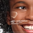 thumbnail image 2 of Crema hidratante Vichy Normaderm Acné Control 2% Ácido Salicílico, 2 of 8