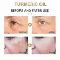 thumbnail image 5 of 30ml Turmeric Oil Pure Natural Pleasant Moisturizing Anti-aging Serum Lighten, 5 of 5