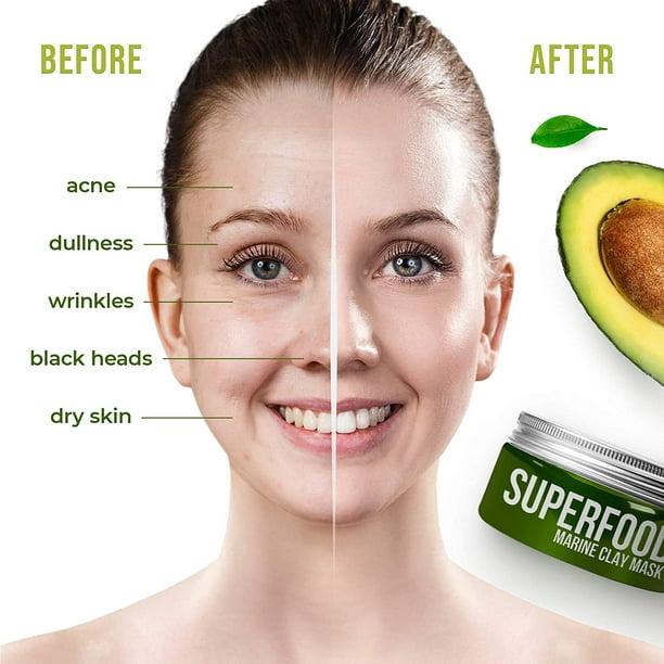 100% Vegan Dead Mud Mask with Avocado & Superfoods - 100ml/3.4 Oz Face Mask for Acne - Dermatologically Tested Hydrating Clay Mask - Blackhead Remover Deep Pore Cleanser and Minimizer - Walmart.com