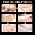 thumbnail image 5 of Botines exfoliantes HUOGUO con aroma a lavanda para talones agrietados, 5 of 5