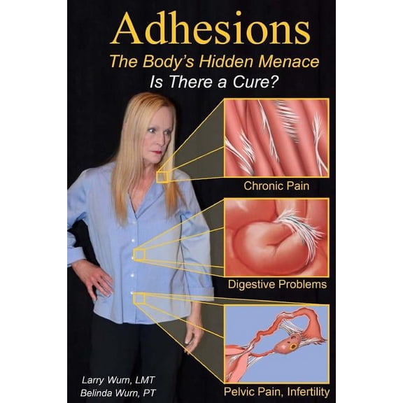 Adhesions: The Body's Inner Menace - Is There a Cure?, (Paperback)