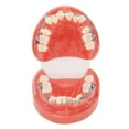 thumbnail image 5 of Alambres De Metal Modelo Dental, Modelo Dental Alambres De Metal 24 Dientes Medio Metal Medio Soporte De Cerámica Diente Modelo Correcto Para La Enseñanza Del Estudio, 5 of 5