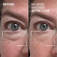 thumbnail image 3 of Gel antihinchazón para ojos Dr. Brandt Needles No More, 30 ml, 3 of 9
