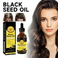 thumbnail image 2 of Herbal Wind Black Seed Oil | Organic Black Seed Oil Liquid | 100% Pure Cold Pressed Black Cumin Nigella Sativa oil | Healthy Skin & Hair | Black Seed & Castor Treatment Oil For Hair & Body 2pcs, 2 of 10