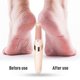 thumbnail image 1 of 26-27 Electric Foot Grinder File Machine Hard Dead Skin Callus Remover Pedicure Tool, 1 of 5