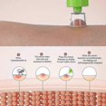 thumbnail image 4 of Bites Relief Suction Tool, Vacuum Venom Extractor For Mosquito Bee Snake Bite, Itch Relief Venom Sucker Emergency Poison Remover For Hiking, 4 of 5