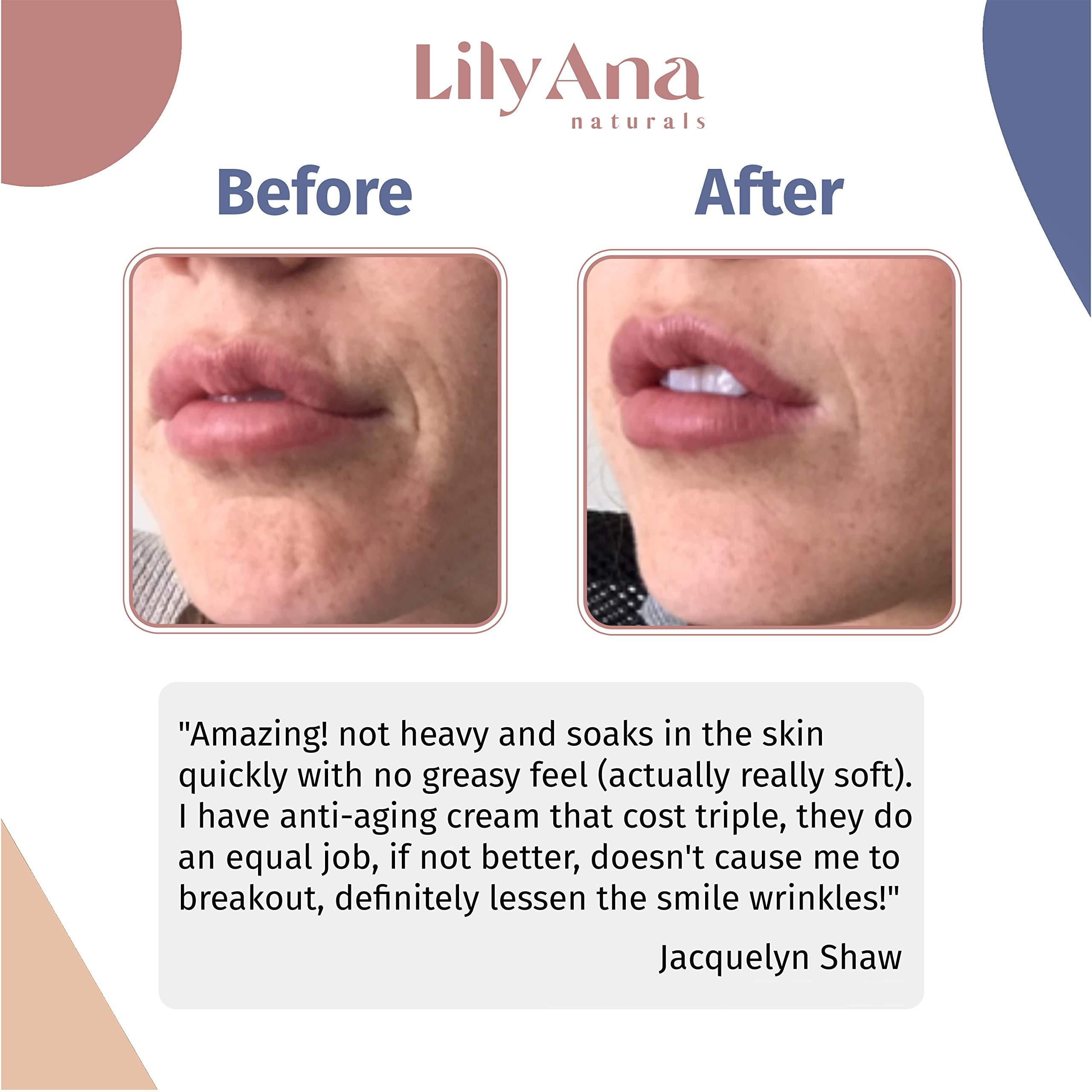 lily ann naturals eye cream reviews