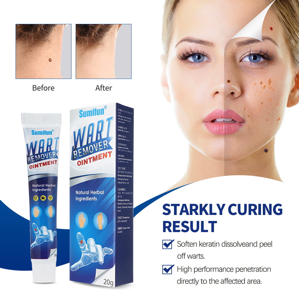 Wart Removal Cream Instant Blemish Removal Gel Effective and Safe Common Wart for Body 20g