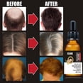 thumbnail image 3 of Aceite esencial para el crecimiento del cabello HUOGUO Plant Anticaída, 30 ml, 3 of 4