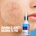 thumbnail image 2 of Serum Anti Acné UNIVERSOENLINEA.COM Bioaqua Pure Skin Cuidado Facial 1 Pieza, 2 of 8
