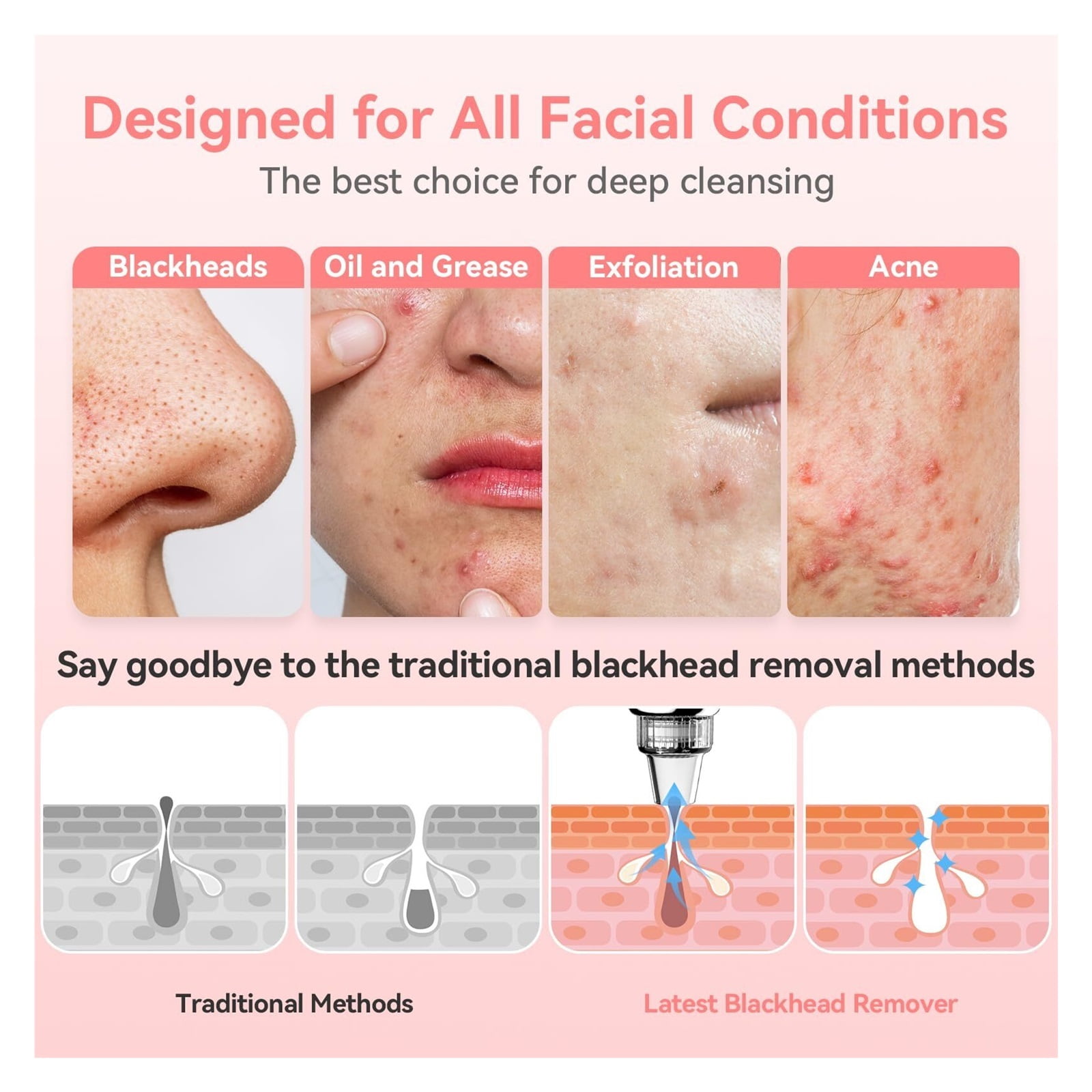 Blackhead Remover Pore Vacuum Upgraded Facial Pore Cleaner Electric Comedone Whitehead Extractor Tool-5 Suction Power,USB Rechargeable Blackhead Vacuum Kit for Women & Men