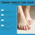 thumbnail image 4 of Esmalte de uñas fortalecedor, líquido para el cuidado de las uñas, tratamiento de la onicomicosis, esmalte reparador y engrosador Soft Armor para uñas de los pies, esmalte especial para el cuidado de, 4 of 9