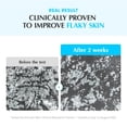 thumbnail image 3 of EQQUALBERRY T&oacute;nico Facial Coreano Milk Toner 300 ml &ndash; Tonico Hidratante Facial Exfoliante Suave Sin Alcohol Para Piel Sensible pH Bajo, 3 of 9