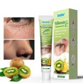 Eye Milia Removal Cream Reduce Puffiness Remove Fat Granule Night