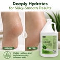 thumbnail image 5 of PRO NAIL - Healing Therapy Massage Lotion - Professional Pedicure, Body and Hot Oil Manicure, Infused with Natural Oils, Vitamins, Panthenol and Amino Acids (Aloe Vera, 1 Gallon), 5 of 7