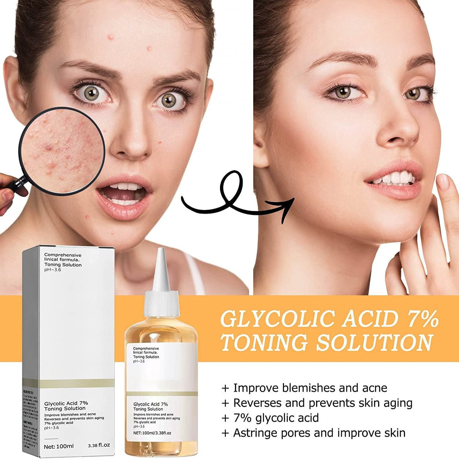 Glycolic Toner Exfoliating Toner Glycolic The-Ordinary - Glycolic Acid 7% Toning Solution(100ml) - Walmart.ca