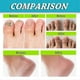 thumbnail image 3 of Foot And Nail Spary, Natural And Powerful Foot Care, 3 of 5