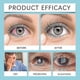 thumbnail image 3 of Presbyopia Vision Care Drops Removal Enhance Eyesight Cataract Cure Relief Eye Pain Blurred Vision Eyeball Fatigue Eye Drops, 3 of 4