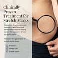 thumbnail image 3 of Skinuva® Next Generation Scar Cream - Stretch Mark Cream Made with Growth Factors, Hyaluronic Acid & Vitamin C for Intense Stretch Mark Removal (2.5 oz), 3 of 7